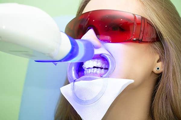 How Can Diet and Lifestyle Choices Affect Teeth Brightness Loughborough