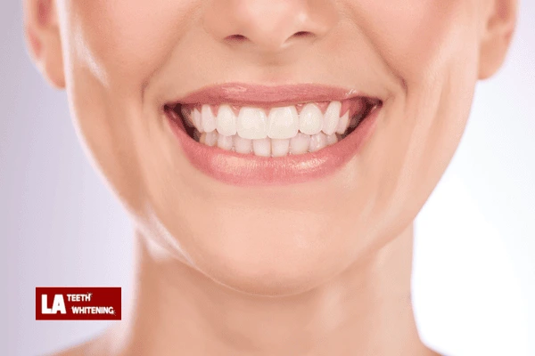 How Can You Get a Brighter Smile Before a Big Event — Without Spending All Day in a Chair Loughborough