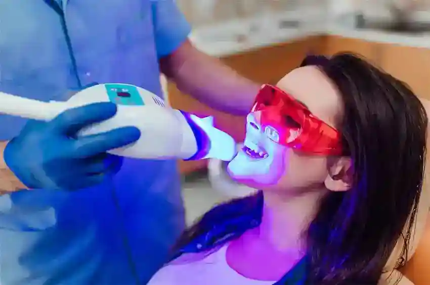 Can You Have Laser Teeth Whitening If You Already Have Dental Work Loughborough