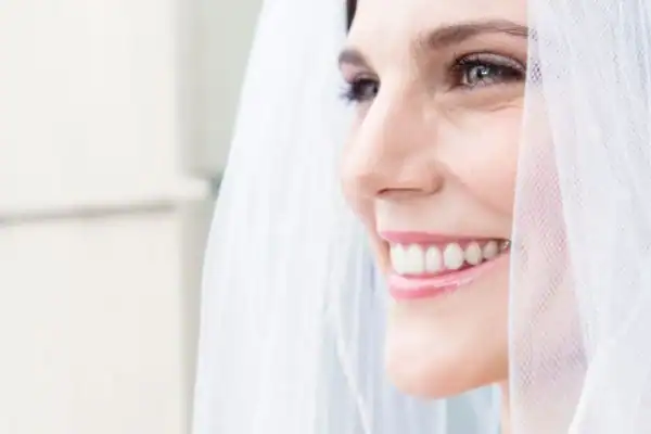 How Can You Make Whitening Last Throughout Your Event (and Beyond) Loughborough