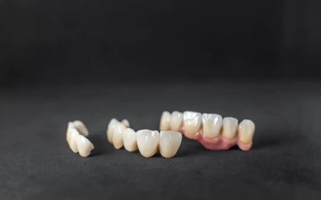 Maintaining a Whiter Smile with Crowns or Veneers: Aftercare Tips from LA Teeth Whitening Loughborough